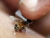 درمان بیماری ها با نیش زنبور